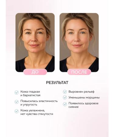 mi&ko FILLER FILLER EXTILLER EXTILLER FILLER EXTILLER - Buy Online on GoSupps.com