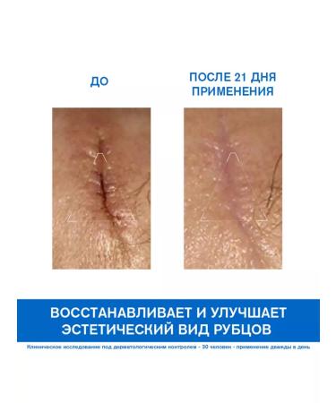 URIAGE Bariederm Cicke cream with copper and zinc 40 ml - Buy Online on GoSupps.com