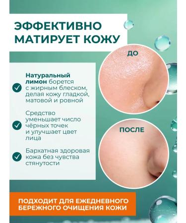 Himalaya Since 1930 Seborrial gel for washing combined skin 2 pcs - Buy Online on GoSupps.com