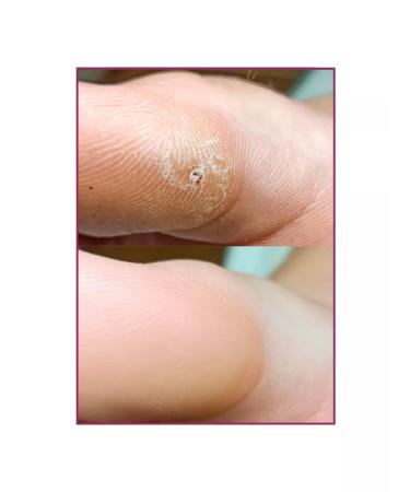Rosilak Oil for growing nails strengthening oncholysis - Buy Online on GoSupps.com