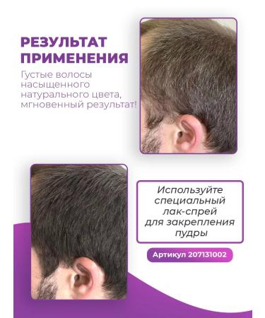 Sevich Hair powder camouflage of falling out and cutting - Buy Online on GoSupps.com