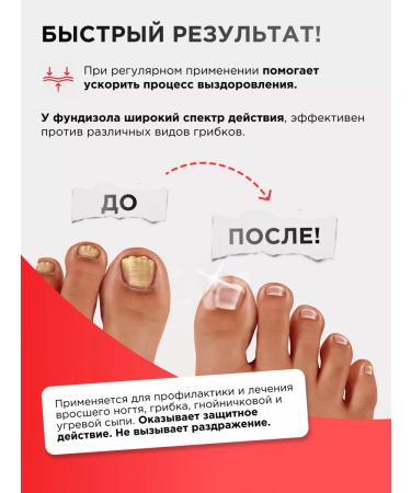 Inpharma Fundizole cream from nail fungus 30 ml - Buy Online on GoSupps.com