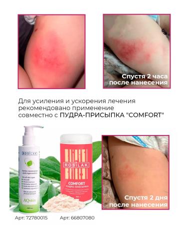 ROSILAK Emolat cream for skin with dryness and inflammation - Buy Online on GoSupps.com