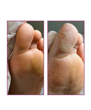 ROSILAK Emolat cream for skin with dryness and inflammation - Buy Online on GoSupps.com