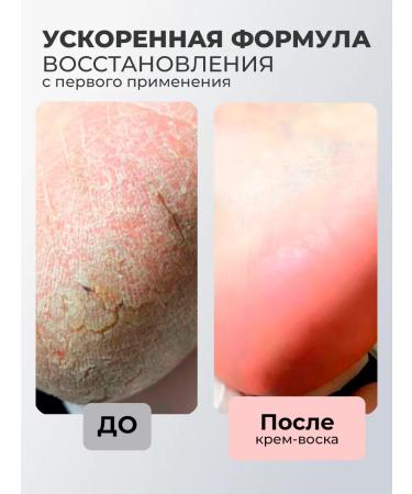 Rosilak Mask Feet and skin wax cream - Buy Online on GoSupps.com