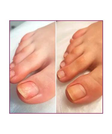 ROSILAK Oil for pedicure of the legs of the skin of the skin - Buy Online on GoSupps.com