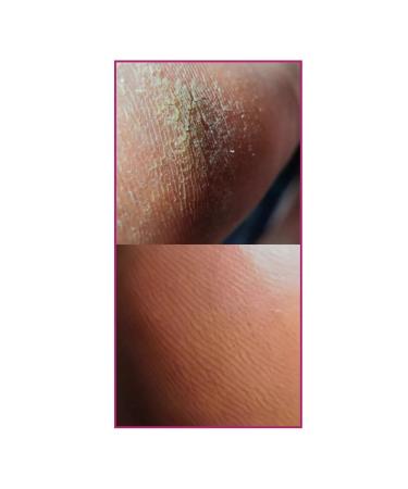 ROSILAK Oil for pedicure of the legs of the skin of the skin - Buy Online on GoSupps.com