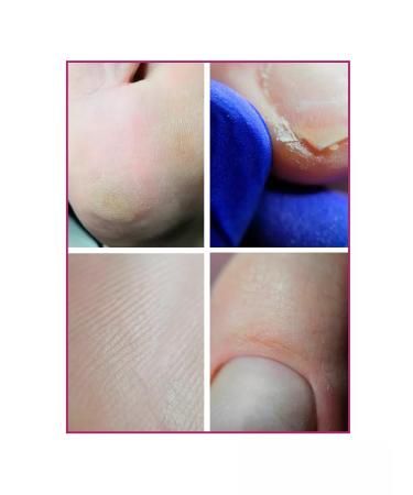 ROSILAK Oil for pedicure of the legs of the skin of the skin - Buy Online on GoSupps.com