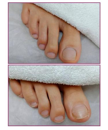 ROSILAK Oil for pedicure of the legs of the skin of the skin - Buy Online on GoSupps.com