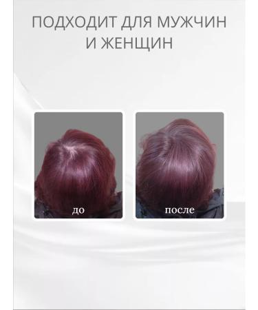 Caboki The thickener of the hair is red red. Auburn - Buy Online on GoSupps.com