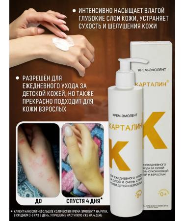 Kartalin Emolet-cream for dry and problematic skin - Buy Online on GoSupps.com