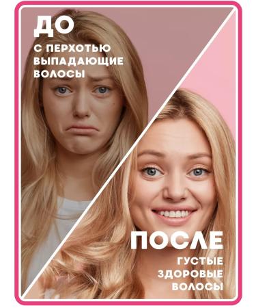 Vitex Mask Massage Massage Massage 2pcs 2pcs - Buy Online on GoSupps.com