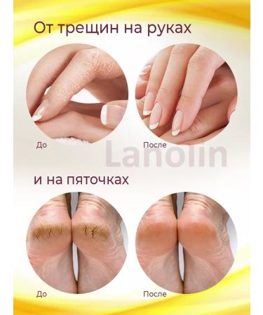 Pixeltap Lanolin for the nipples of the breasts of the lips - Buy Online on GoSupps.com