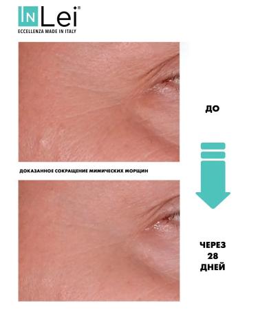 Inlei Miami cream rejuvenating around the eyes - Buy Online on GoSupps.com