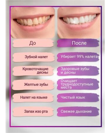 Yasdevice Irrigator Luhase for the oral cavity - Buy Online on GoSupps.com