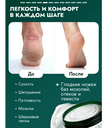 Semily Moisturizer with urea from cracks and calluses - Buy Online on GoSupps.com