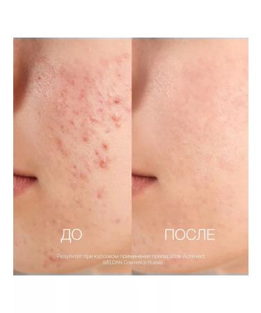 Eldan Cosmetics Cream for problem skin - Buy Online on GoSupps.com