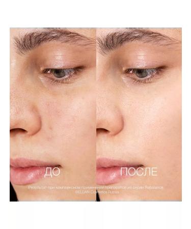 Eldan Cosmetics Face cream is rebalassing for problem skin 50 ml - Buy Online on GoSupps.com