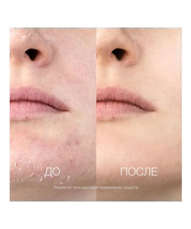 Eldan Cosmetics Professional Aha Lotion Milk - Buy Online on GoSupps.com