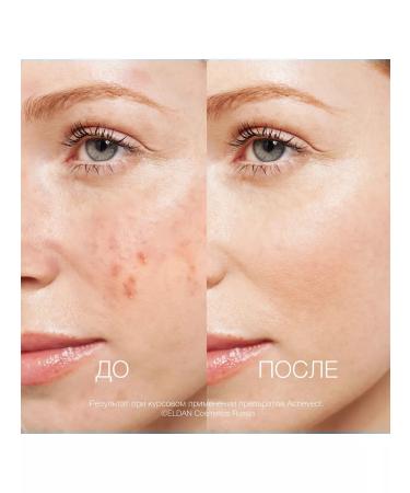 Eldan Cosmetics Professional therapeutic acne-glue - Buy Online on GoSupps.com