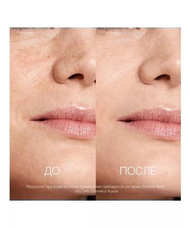 Eldan Cosmetics Premium Biotox-Time Lifting Crem - Buy Online on GoSupps.com