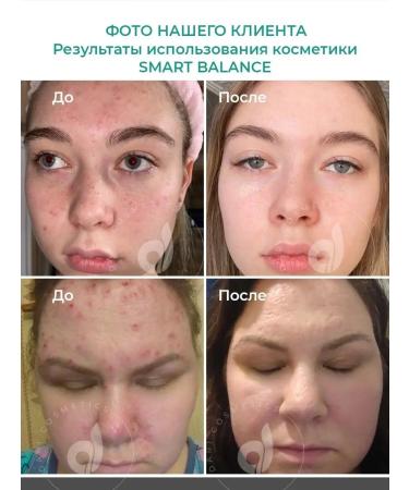 Dari cosmetics Face wash gel - Buy Online on GoSupps.com