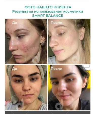 Dari cosmetics Facial tonic hyaluronic matting - Buy Online on GoSupps.com