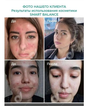 Dari cosmetics Facial serum from acne and post -hot Serum - Buy Online on GoSupps.com