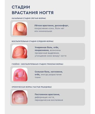 INKI Collagen serum to soften the ingrown nail - Buy Online on GoSupps.com