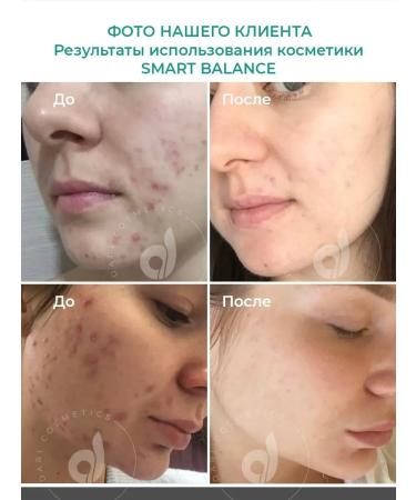 Dari cosmetics Spot corrector from acne and acne 15ml - Buy Online on GoSupps.com