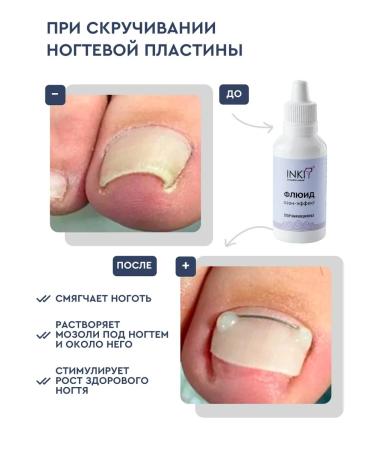 INKI Remedy for ingrown nails on the legs and hands of ozone effect - Buy Online on GoSupps.com