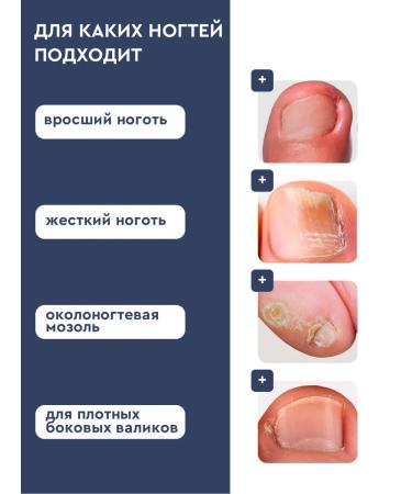 INKI Softening oil for an ingrown nail and cutting for a cuticle - Buy Online on GoSupps.com