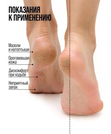 7DAYS Legs with urea from cracks moisturizing set 2 pcs - Buy Online on GoSupps.com