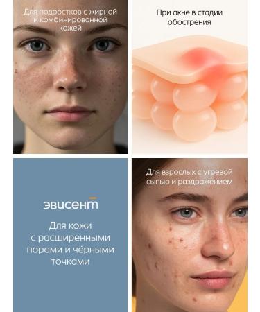 EVISENT Foam for washing the face from acne - Buy Online on GoSupps.com