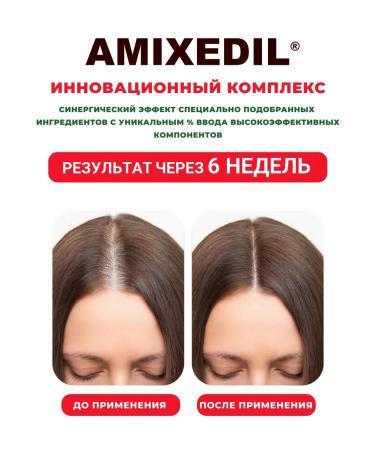Horsepower Shampoo for growth and from hair loss Resuscitator 500ml - Buy Online on GoSupps.com