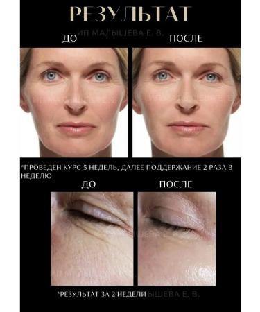 TROPICANA Wrinkle cream with snake venom Syn-Ake Cobra Cream - Buy Online on GoSupps.com