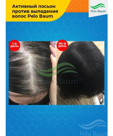 Pelo Baum Lotion growth stimulator sang baum 60 ml - Buy Online on GoSupps.com