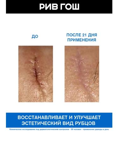 URIAGE Bariederm-Cica Body cream with copper and zinc 40 ml - Buy Online on GoSupps.com