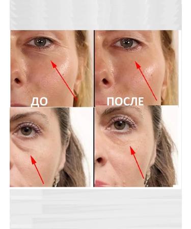 RtopR Cosmetic Anti -aging cream for the area around the eyes - Buy Online on GoSupps.com
