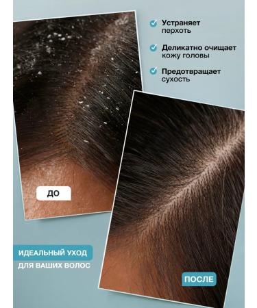 Tashe Piling for scalp and hair from dandruff - Buy Online on GoSupps.com