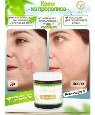 ALTIN SOLOK Propolis cream - Buy Online on GoSupps.com