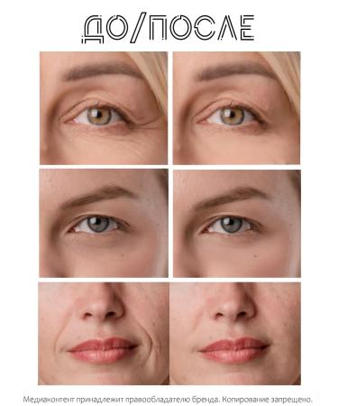 IMAGES Patches for the eyes from edema wrinkles and dark circles - Buy Online on GoSupps.com