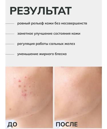 LSANIC Hel to wash the face with PHA acids Korea 150 ml - Buy Online on GoSupps.com