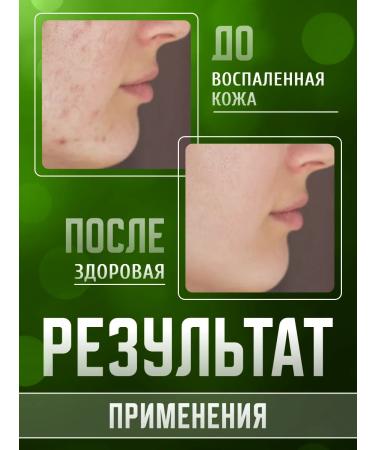 Spring Chapter soap firm -sided chusel 90 g 6 pcs - Buy Online on GoSupps.com