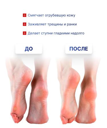 NICOLE LABORATORY Feet cream from cracks and dryness - Buy Online on GoSupps.com