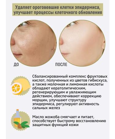 BELITA Past - Facial Biopilings with AHA acids - Buy Online on GoSupps.com