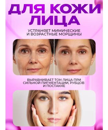 DRS540 Minoxidil Mesoroller for the face and body 0.5 mm - Buy Online on GoSupps.com