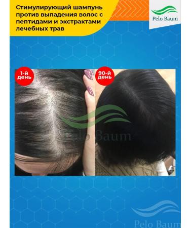 Pelo Baum Shampoo+air conditioning+lotion for hair growth - Buy Online on GoSupps.com