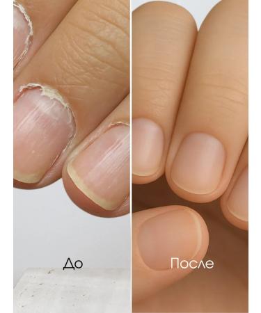 Bandi Whey for dry nails Nourishing Blue Serum - Buy Online on GoSupps.com