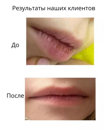 DIVO DON Moisturizing lip balm with SPF - Buy Online on GoSupps.com